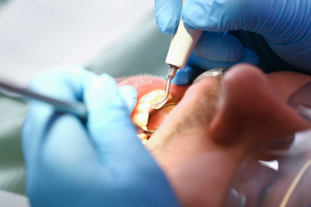 Best Emergency Gum Treatment in Olympia Fields, IL